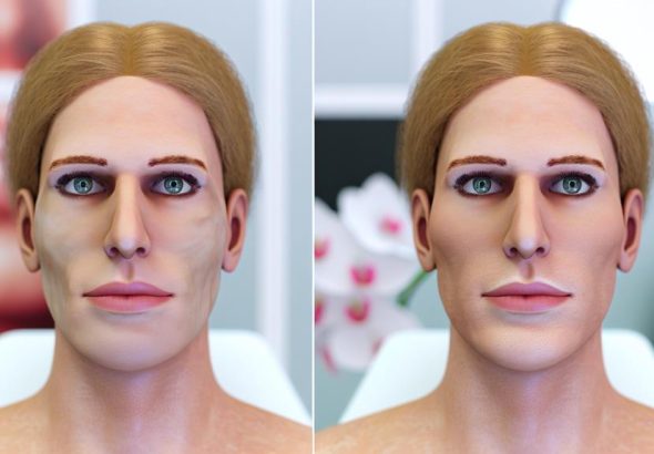 facial surgery for transgender individuals