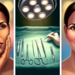 facial feminization surgery journey